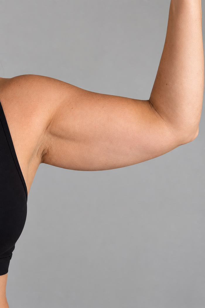 Arms